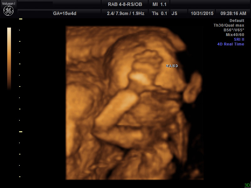 4d view ultrasound file